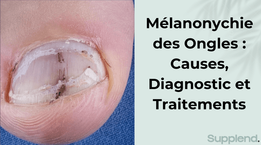 Mélanonychie des Ongles : Causes, Diagnostic et Traitements